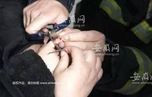 女童食指被“铁环”夹住 宿州消防员成功施救