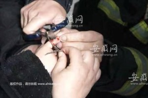 女童食指被“铁环”夹住 宿州消防员成功施救